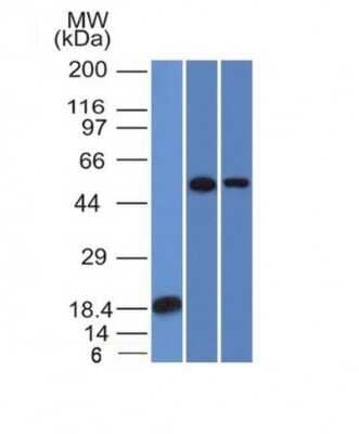 Western Blot TOX3 Antibody (TOX3/1124)