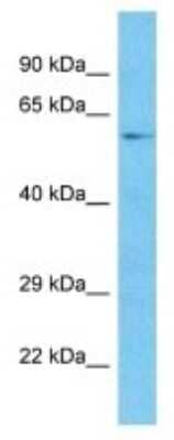 Western Blot: TOX3 Antibody [NBP3-10590] - Western blot analysis of TOX3 in 293T Whole Cell lysates. Antibody dilution at 1.0ug/ml
