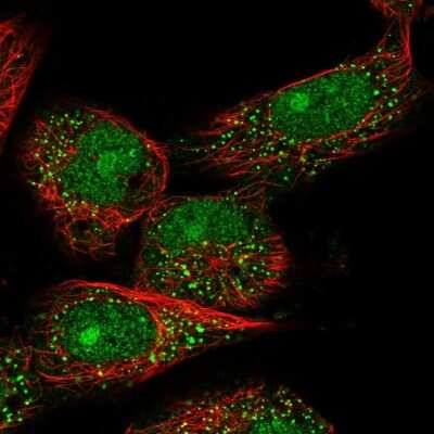 Immunocytochemistry/Immunofluorescence: TOX4 Antibody [NBP1-88432] - Immunofluorescent staining of human cell line U-251 MG shows localization to nucleus, nucleoli & vesicles.