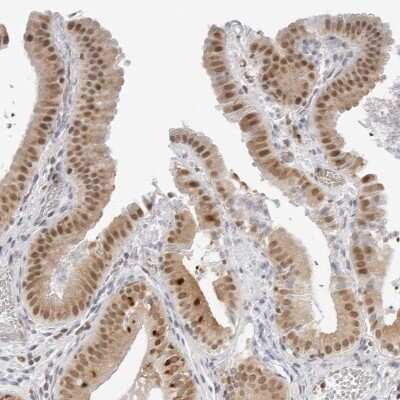 Immunohistochemistry-Paraffin: TOX4 Antibody [NBP1-88432] - Staining of human gallbladder shows moderate nuclear positivity in glandular cells.