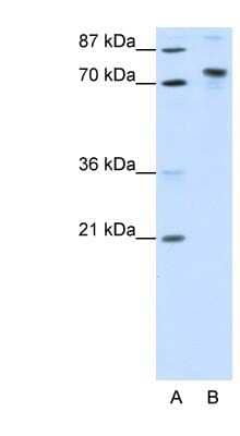 Western Blot: TOX4 Antibody [NBP1-80328] - Titration: 1.25ug/ml, Positive Control: Transfected 293T.