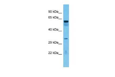Western Blot: TOX4 Antibody [NBP2-88320] - Host: Rabbit. Target Name: TOX4. Sample Type: Lung tumor lysates. Antibody Dilution: 1.0ug/ml