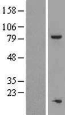 Western Blot: TOX4 Overexpression Lysate (Adult Normal) [NBL1-17202] Left-Empty vector transfected control cell lysate (HEK293 cell lysate); Right -Over-expression Lysate for TOX4.
