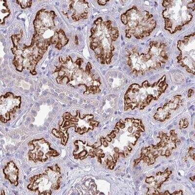 Immunohistochemistry-Paraffin: TP53I11 Antibody [NBP2-32491] - Staining of human kidney shows strong luminal membranous positivity in cells in tubules.