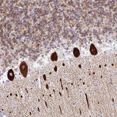 Immunohistochemistry-Paraffin: TP53I11 Antibody [NBP2-32593] - Staining of human cerebellum shows strong cytoplasmic positivity in Purkinje cells.