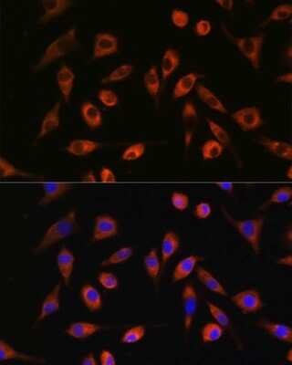 Immunocytochemistry/Immunofluorescence: TP53I13 Antibody [NBP2-94004] - Analysis of L929 cells using TP53I13 at dilution of 1:100. Blue: DAPI for nuclear staining.