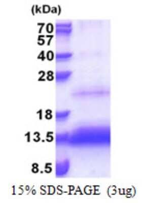 SDS-Page: Recombinant Human HSPC132 Protein [NBP2-22873]