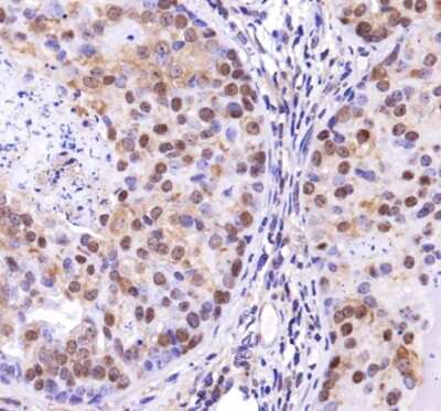 Immunohistochemistry TP53INP2 Antibody - BSA Free