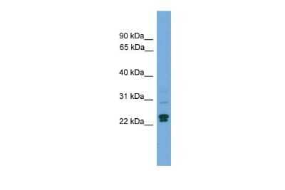 Western Blot TP53INP2 Antibody