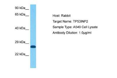 Western Blot: TP53INP2 Antibody [NBP2-84309] - Host: Rabbit. Target Name: TP53INP2. Sample Tissue: Human A549 Whole Cell. Antibody Dilution: 1ug/ml