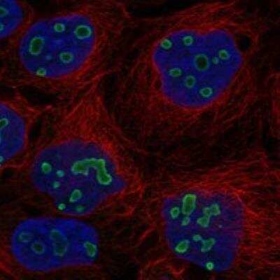 Immunocytochemistry/Immunofluorescence: TP53TG5 Antibody [NBP3-17044] - Staining of human cell line CACO-2 shows localization to nucleoli rim.