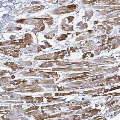 Immunohistochemistry TP53TG5 Antibody - BSA Free