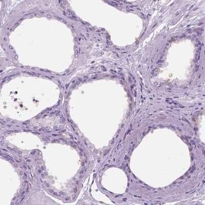 Immunohistochemistry-Paraffin TP53TG5 Antibody - BSA Free