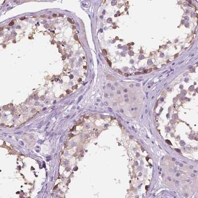 Immunohistochemistry-Paraffin TP53TG5 Antibody - BSA Free