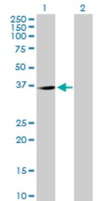 Western Blot: TP53TG5 Antibody [H00027296-B01P] - Analysis of TP53TG5 expression in transfected 293T cell line by TP53TG5 polyclonal antibody.  Lane 1: C20orf10 transfected lysate(31.9 KDa). Lane 2: Non-transfected lysate.