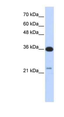 Western Blot: TP53TG5 Antibody [NBP1-58924] - Titration: 0.2-1 ug/ml, Positive Control: Transfected 293T.