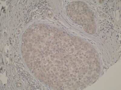 Immunohistochemistry-Paraffin TP53TG5 Antibody (Z38P1E4*C7) - BSA Free