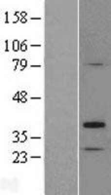 Western Blot TP53TG5 Overexpression Lysate