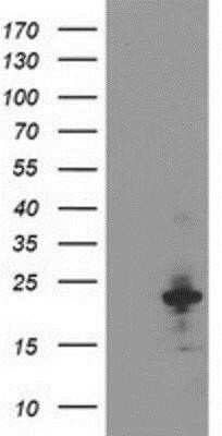 Western Blot: TP73-AS1 Antibody (OTI2B9) - Azide and BSA Free [NBP2-74559] - HEK293T cells were transfected with the pCMV6-ENTRY control (Left lane) or pCMV6-ENTRY TP73-AS1 (Right lane) cDNA for 48 hrs and lysed. Equivalent amounts of cell lysates (5 ug per lane) were separated by SDS-PAGE and immunoblotted with anti-TP73-AS1.