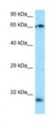 Western Blot: TP73-AS1 Antibody [NBP1-98566] - Jurkat Cell Lysate 1.0ug/ml, Gel Concentration: 12%