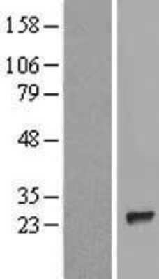 Western Blot: TP73-AS1 Overexpression Lysate (Adult Normal) [NBL1-12249] Left-Empty vector transfected control cell lysate (HEK293 cell lysate); Right -Over-expression Lysate for TP73-AS1.