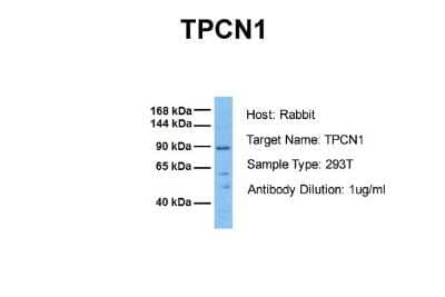 Western Blot TPCN1 Antibody