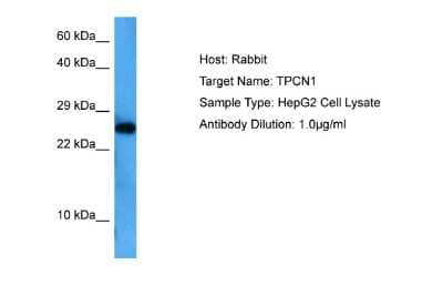 Western Blot: TPCN1 Antibody [NBP2-83710] - Host: Rabbit. Target Name: TPCN1. Sample Tissue: Human HepG2 Whole Cell lysates. Antibody Dilution: 1ug/ml