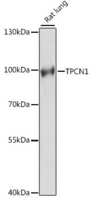 Western Blot TPCN1 Antibody - Azide and BSA Free