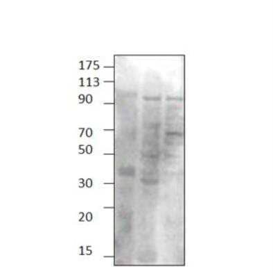 Western Blot TPCN1 Antibody