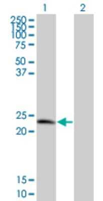 Western Blot: TPD52 Antibody (1B6) [H00007163-M01] - Analysis of TPD52 expression in transfected 293T cell line by TPD52 monoclonal antibody (M01), clone 1B6.Lane 1: TPD52 transfected lysate(19.863 KDa).Lane 2: Non-transfected lysate.