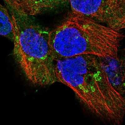 Immunocytochemistry/Immunofluorescence: TPD52 Antibody [NBP2-38952] - Staining  of human cell line A-431 shows positivity in cytoplasm and the Golgi apparatus.