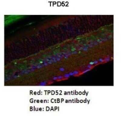 Immunohistochemistry: TPD52 Antibody [NBP1-56457] - Mouse retina Dilution: 1: 200 Secondary antibody: Goat anti-rabbit Alexafluor 568 Secondary antibody dilution: 1: 200 - See more at: