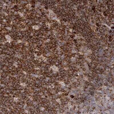 Immunohistochemistry-Paraffin: TPD52 Antibody [NBP1-85327] - Staining of human tonsil shows strong cytoplasmic positivity in most cells.