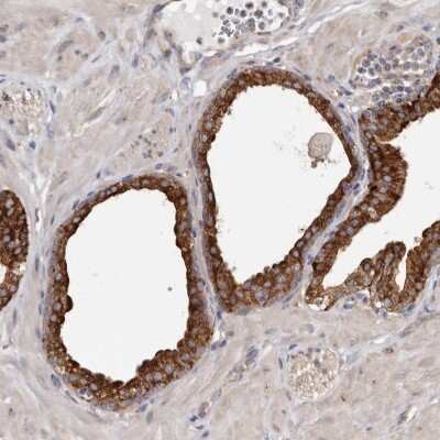 Immunohistochemistry-Paraffin: TPD52 Antibody [NBP1-85327] - Staining of human prostate shows high expression.