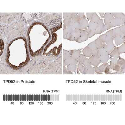 <b>Orthogonal Strategies Validation. </b>Immunohistochemistry-Paraffin: TPD52 Antibody [NBP1-85327] - Staining in human prostate and skeletal muscle tissues using anti-TPD52 antibody. Corresponding TPD52 RNA-seq data are presented for the same tissues.