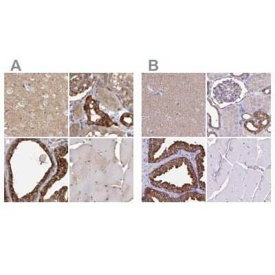 <b>Independent Antibodies Validation. </b>Immunohistochemistry-Paraffin: TPD52 Antibody [NBP1-85327] - Staining of human cerebral cortex, kidney, prostate and skeletal muscle using Anti-TPD52 antibody NBP1-85327 (A) shows similar protein distribution across tissues to independent antibody NBP2-38952 (B).