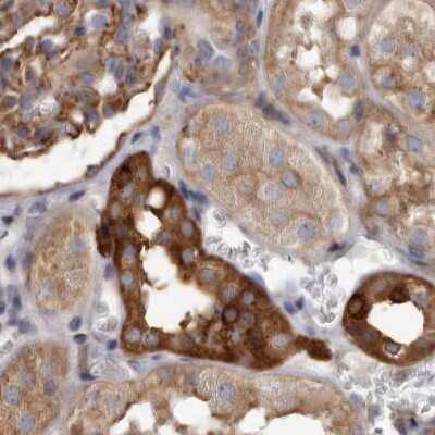 Immunohistochemistry-Paraffin: TPD52 Antibody [NBP1-85327] - Staining of human kidney.