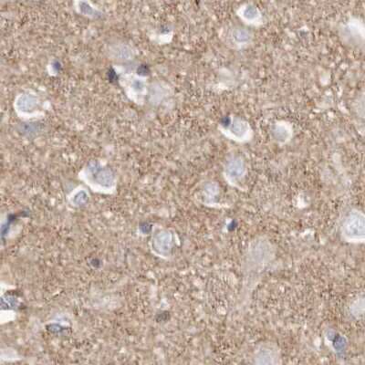 Immunohistochemistry-Paraffin: TPD52 Antibody [NBP1-85327] - Staining of human cerebral cortex.