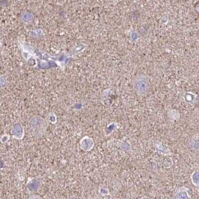 Immunohistochemistry-Paraffin: TPD52 Antibody [NBP2-38952] - Staining of human cerebral cortex.