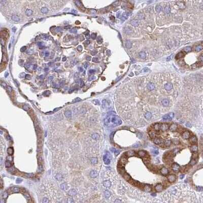 Immunohistochemistry-Paraffin: TPD52 Antibody [NBP2-38952] - Staining of human kidney.