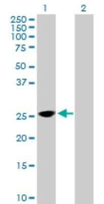 Western Blot: TPD52 Antibody [H00007163-B01P] - Analysis of TPD52 expression in transfected 293T cell line by TPD52 polyclonal antibody.  Lane 1: TPD52 transfected lysate(20.24 KDa). Lane 2: Non-transfected lysate.