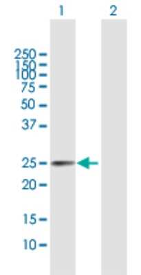 Western Blot: TPD52 Antibody [H00007163-B02P] - Analysis of TPD52 expression in transfected 293T cell line by TPD52 polyclonal antibody.  Lane 1: TPD52 transfected lysate(19.90 KDa). Lane 2: Non-transfected lysate.