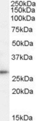 Western Blot: TPD52 Antibody [NBP1-06090] - (1ug/ml) staining of Human Lymph Node lysate (35ug protein in RIPA buffer). Primary incubation was 1 hour. Detected by chemiluminescence.