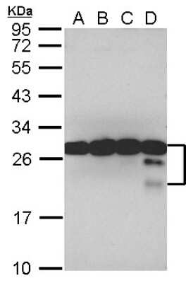 Western Blot: TPD52 Antibody [NBP2-20686] - Sample (30 ug of whole cell lysate) A: A549 B: H1299 C: HCT116 D: MCF-7 12% SDS PAGE gel, diluted at 1:10000.