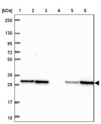 Western Blot: TPD52 Antibody [NBP2-38952] - Lane 1: Marker  [kDa] 250, 130, 95, 72, 55, 36, 28, 17, 10.  Lane 2: Human cell line RT-4.  Lane 3: Human cell line U-251MG.  Lane 4: Human Plasma.  Lane 5: Human liver tissue.  Lane 6: Human tonsil tissue