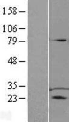 Western Blot: TPD52 Overexpression Lysate (Adult Normal) [NBL1-17212] Left-Empty vector transfected control cell lysate (HEK293 cell lysate); Right -Over-expression Lysate for TPD52.