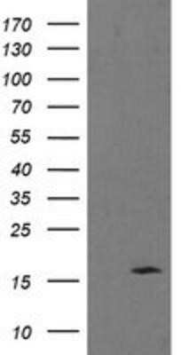 Western Blot: TPD52L3/D55 Antibody (OTI6E1) - Azide and BSA Free [NBP2-74565] - HEK293T cells were transfected with the pCMV6-ENTRY control (Left lane) or pCMV6-ENTRY TPD52L3/D55 (Right lane) cDNA for 48 hrs and lysed. Equivalent amounts of cell lysates (5 ug per lane) were separated by SDS-PAGE and immunoblotted with anti-TPD52L3/D5