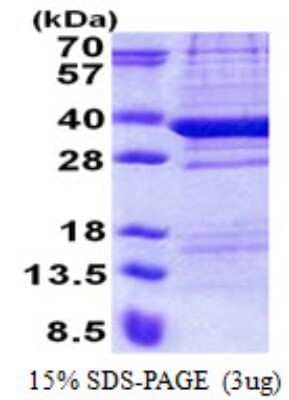 SDS-Page: TPGS2 Protein [NBP2-22899]