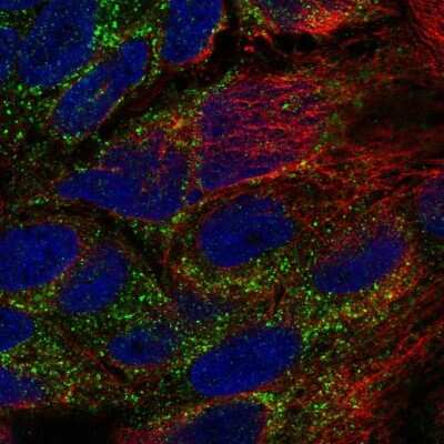 Immunocytochemistry/ Immunofluorescence TPK1 Antibody