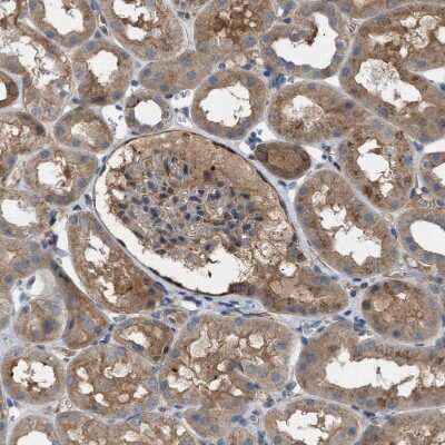 Immunohistochemistry: TPK1 Antibody [NBP1-83151] - Staining of human kidney shows weak to moderate cytoplasmic positivity in cells in tubules.